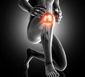 knee osteoarthritis - knee pain