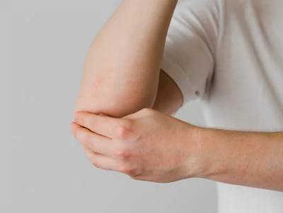 golfer's elbow - close-up-patient-elbow-issues